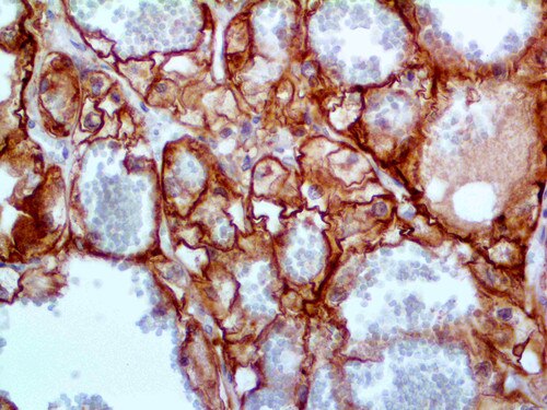 IHC of Ksp-Cadherin on an FFPE Kidney Tissue